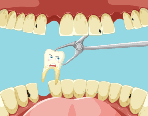 Everything you need to know when removing a tooth